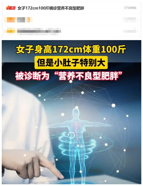 熱搜第一！女子172cm100斤確診營養(yǎng)不良型肥胖
